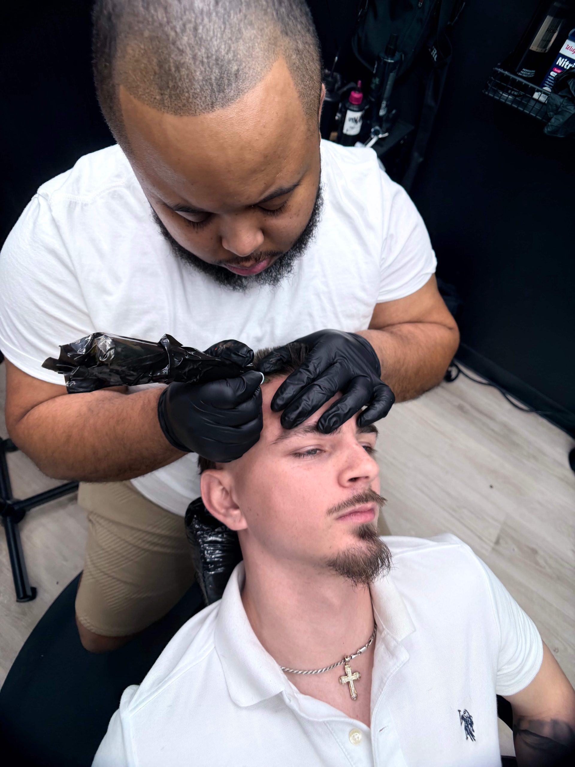 SMP treatment in progress FadezByBoda